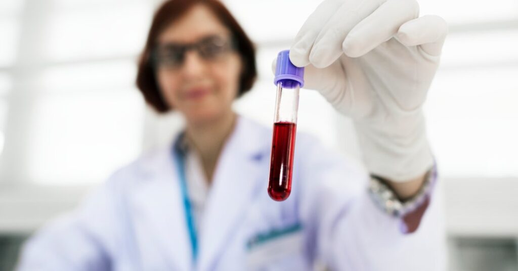 CA 125: entenda quando fazer exame que diagnostica tumores ginecológicos