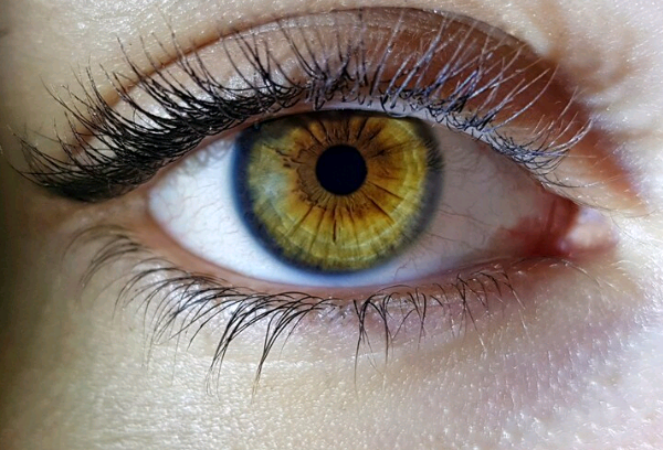 Cirurgia para mudar a cor dos olhos vira ‘febre’ entre adolescentes