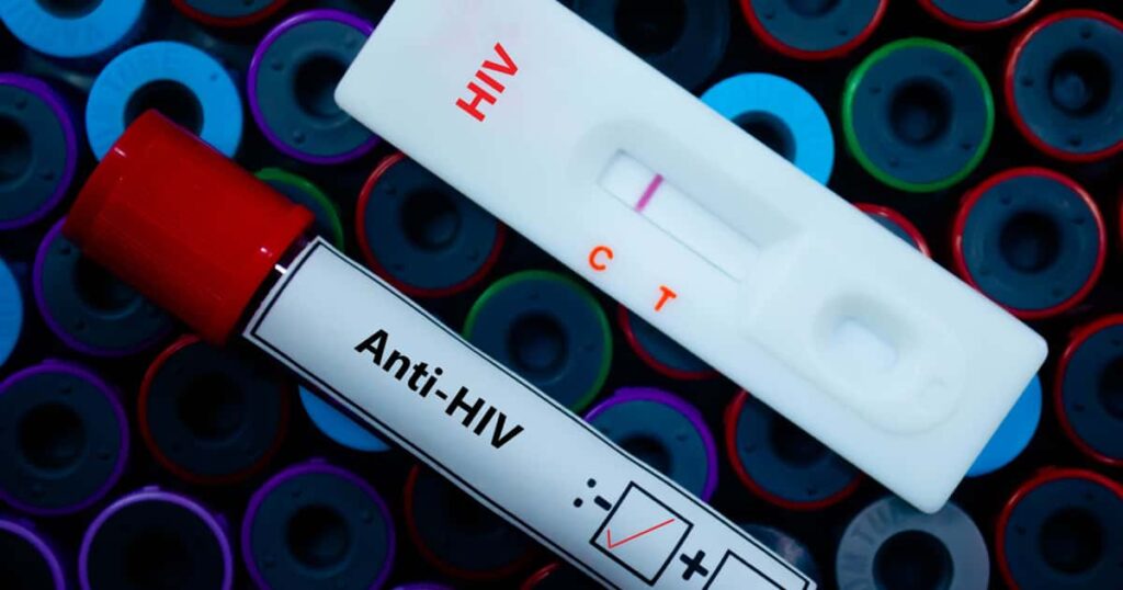 Injeção semestral contra HIV mostra eficácia de 99,9%