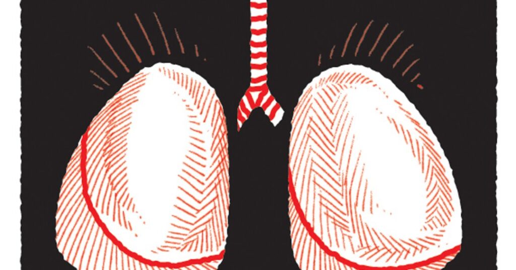 Sotatercept: Novo medicamento reduz risco de morte por hipertensão arterial pulmonar