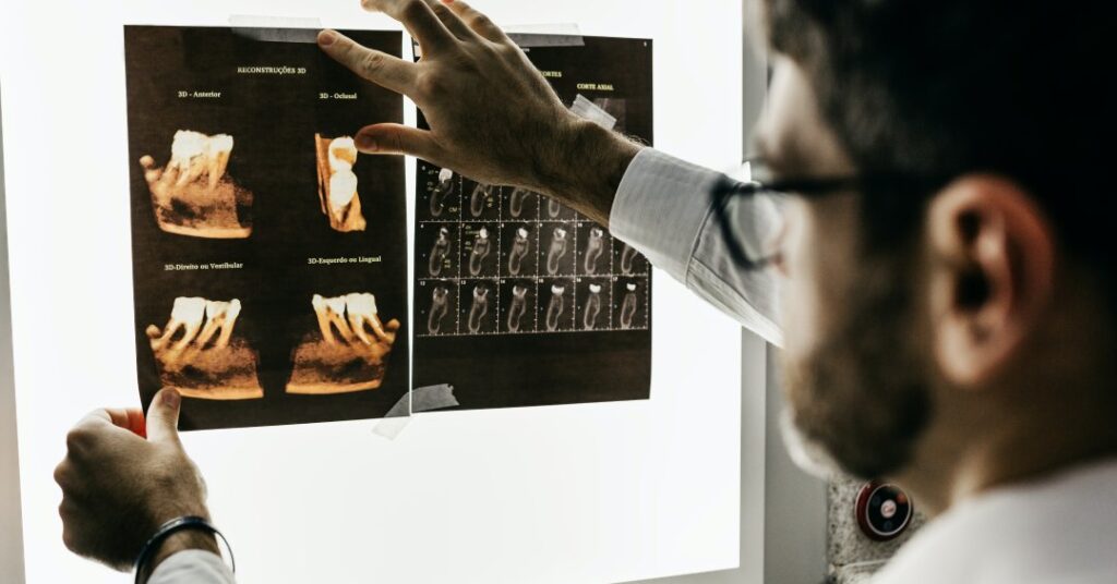 Exercício e ômega-3 podem aliviar infecção na raiz do dente, diz estudo brasileiro