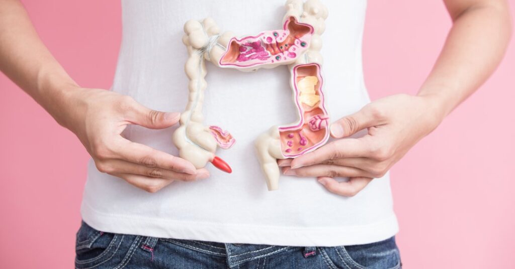 Câncer de intestino cresce entre jovens e muda regras de rastreamento