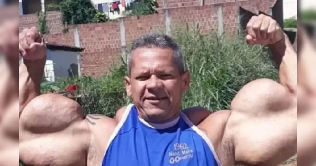 Morre Arlindo de Souza, conhecido como "Popeye Brasileiro"