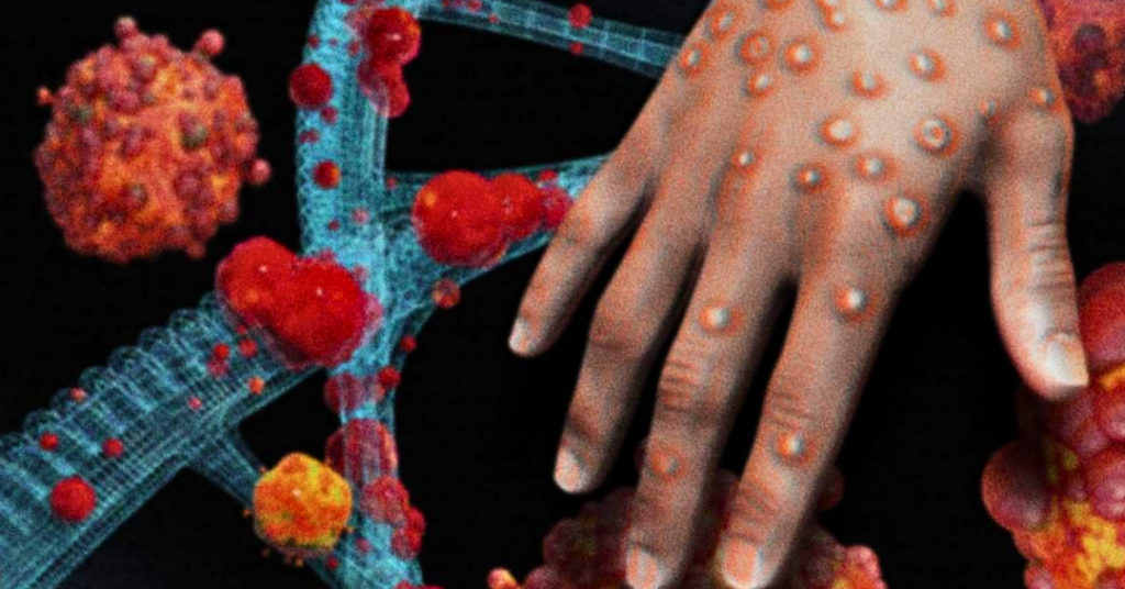 Aprenda a identificar as lesões do mpox e o que fazer se notar sintomas