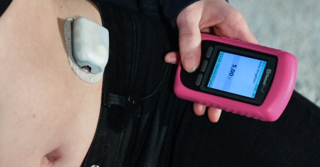 Bomba de insulina para quem tem diabetes tipo 1: entenda decisão do STJ