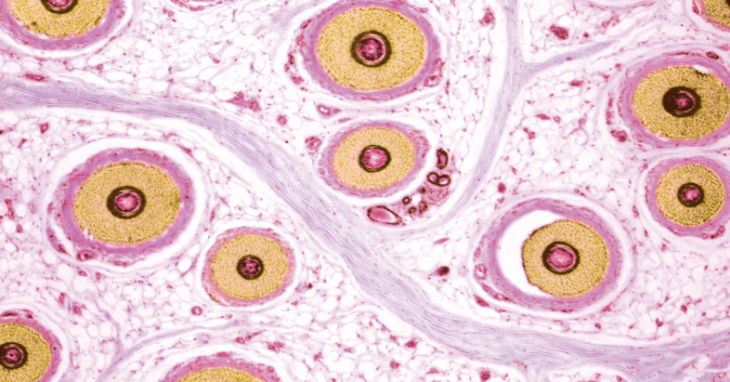 De onde saem os pelos do corpo? Superzoom revela detalhes impressionantes dessas estruturas