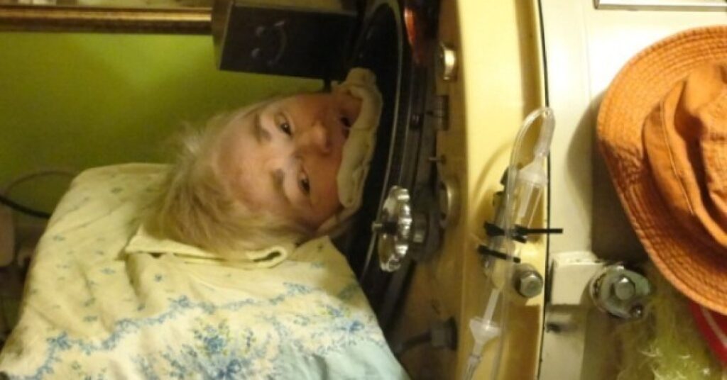 Quem era Martha Lillard, última americana a viver em um pulmão de aço por causa da pólio