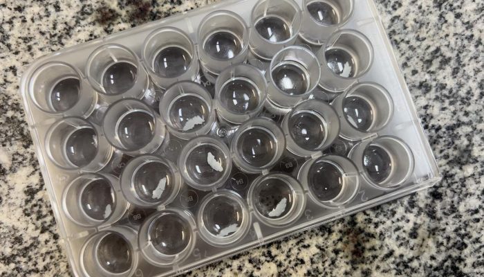 1 de 4Tecido cerebral humano usado no estudo; modelo permite observar como vírus infectam células reais do cérebro adulto — Foto: Murilo Corazza/g1