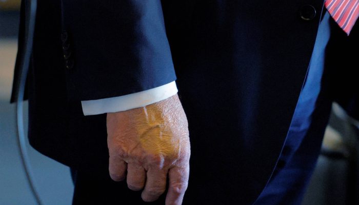 Maquiagem cobre o dorso da mão do presidente dos EUA, Donald Trump, em maio de 2025
             -       
        Brian Snyder-14.mai.25/Reuters