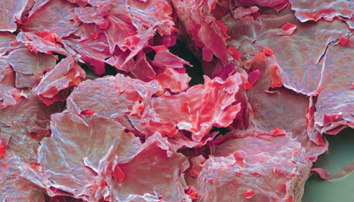 Zoom: folhas secas