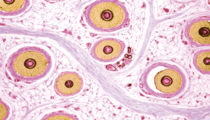 De onde saem os pelos do corpo? Superzoom revela detalhes impressionantes dessas estruturas