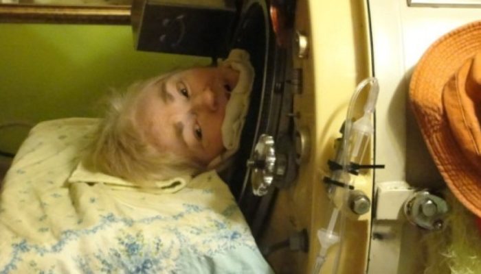 Quem era Martha Lillard, última americana a viver em um pulmão de aço por causa da pólio