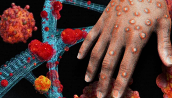 Aprenda a identificar as lesões do mpox e o que fazer se notar sintomas