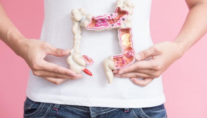 Câncer de intestino cresce entre jovens e muda regras de rastreamento