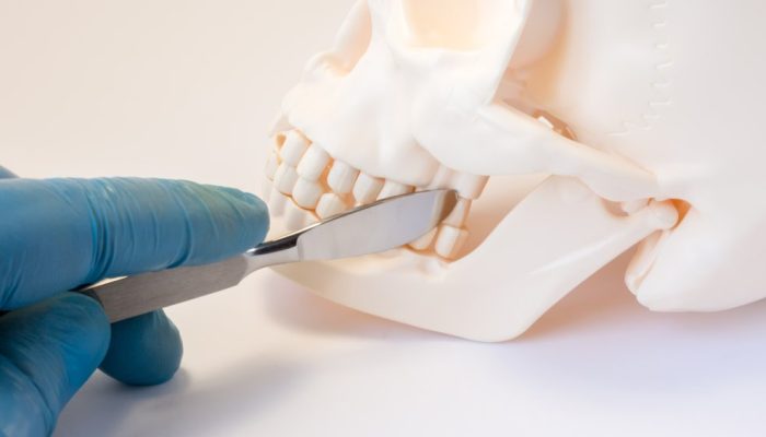 Estudo revela impacto das deformidades faciais na saúde mental