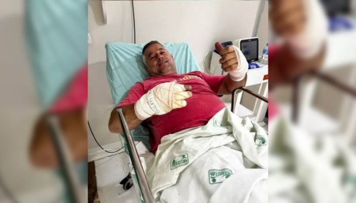 Piloto sofre queimaduras após incêndio em corrida em autódromo no PR