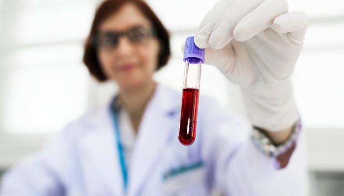 CA 125: entenda quando fazer exame que diagnostica tumores ginecológicos