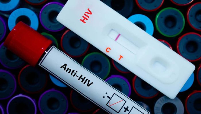 Injeção semestral contra HIV mostra eficácia de 99,9%