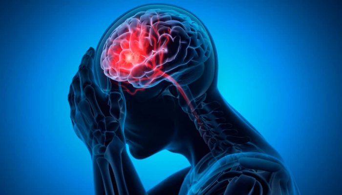 Sinal de derrame pode aparecer nos olhos uma semana antes
