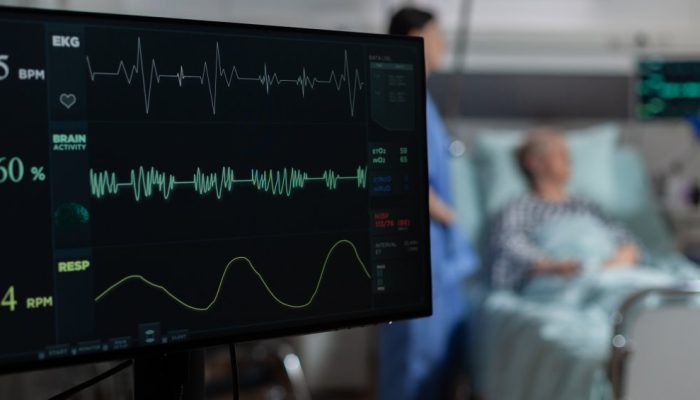 ECMO: conheça a máquina que substitui pulmão e coração em casos graves