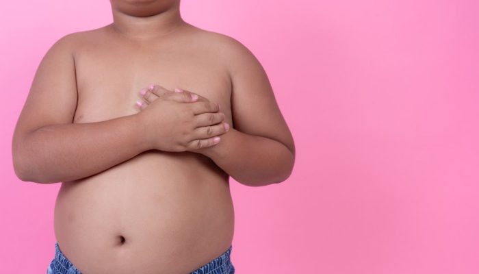 Guia dá dicas práticas para lidar com a obesidade infantil