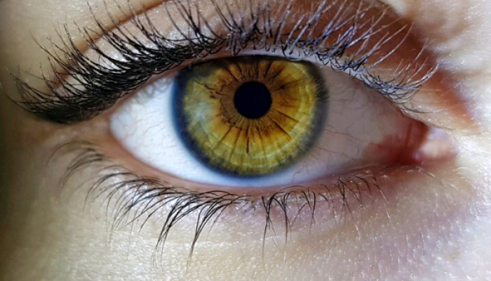 Cirurgia para mudar a cor dos olhos vira ‘febre’ entre adolescentes