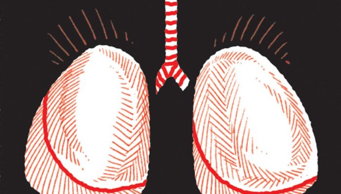Sotatercept: Novo medicamento reduz risco de morte por hipertensão arterial pulmonar