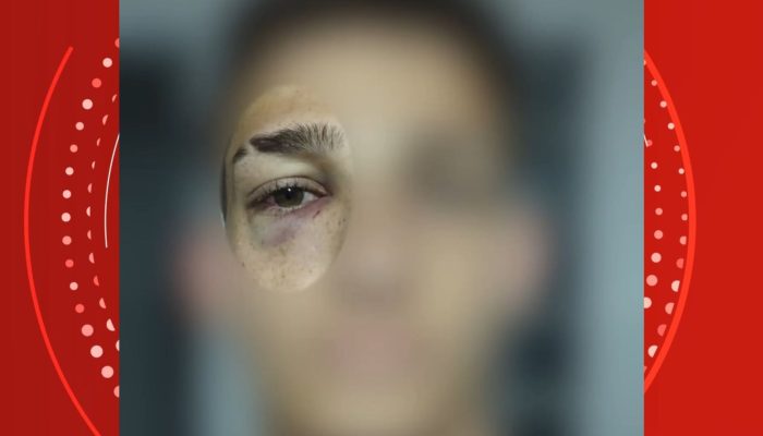 1 de 2Jovem denuncia agressão de supervisor durante rescisão de contrato em Guarapari — Foto: TV Gazeta