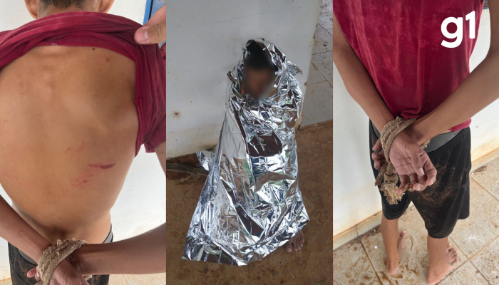 1 de 1A vítima foi resgatada com vários ferimentos espalhados pelo corpo — Foto: Polícia Militar