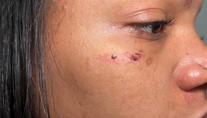 1 de 3Alguns dos machucados no rosto da grávida que foi agredida por um homem na rua em General Salgado (SP) — Foto: David Santos/TV TEM